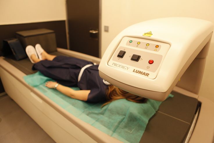 El diagnóstico precoz de la osteoporosis mediante Densitometría ósea